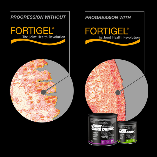 Fortigel - Progression